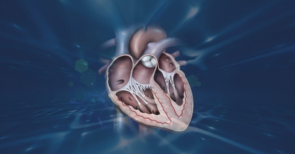 heart failure stories