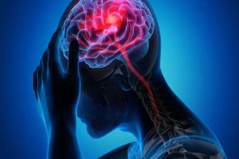 how do you know if you had a stroke