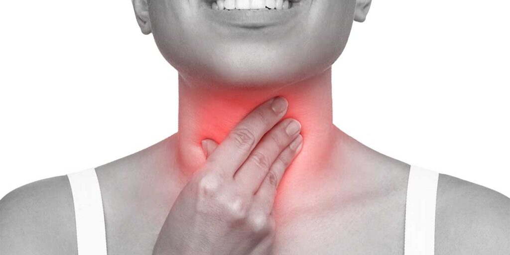 strept throat